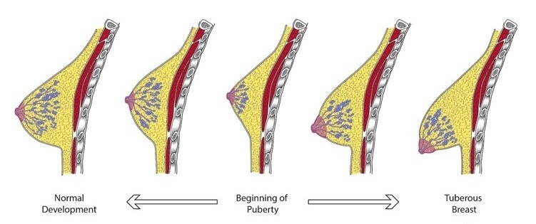 Стоковые векторные изображения по запросу Женская грудь